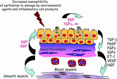 Diagramatic representation of the epithelial mesenchumal trphic unit in asthma drive by the release of epithelial derived growth factors